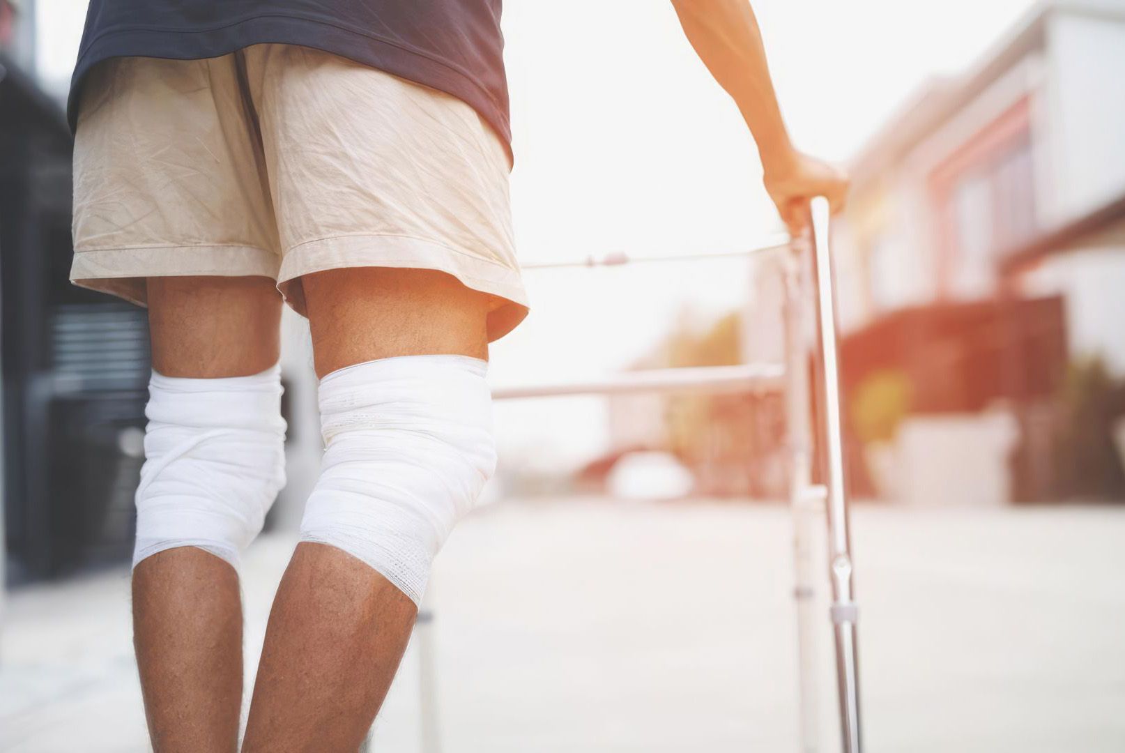 Personal Injury Lawyer in Chatsworth case involving a person with bandaged knee injuries using crutches during recovery.